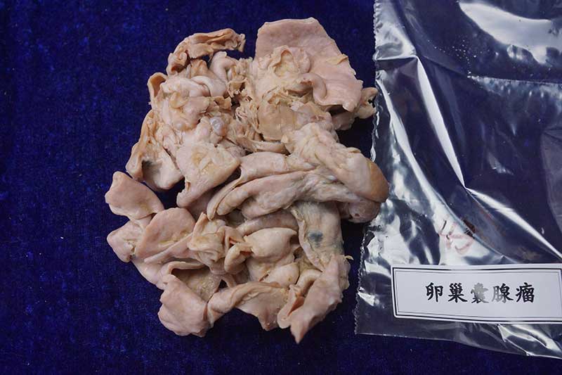 人体病理标本