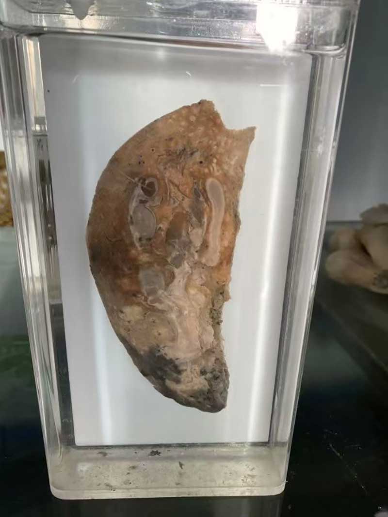 人体病理标本