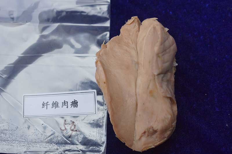 人体病理标本