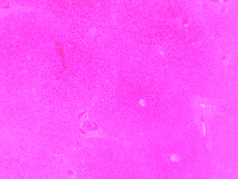 肝淤血-10倍（第二个版本）