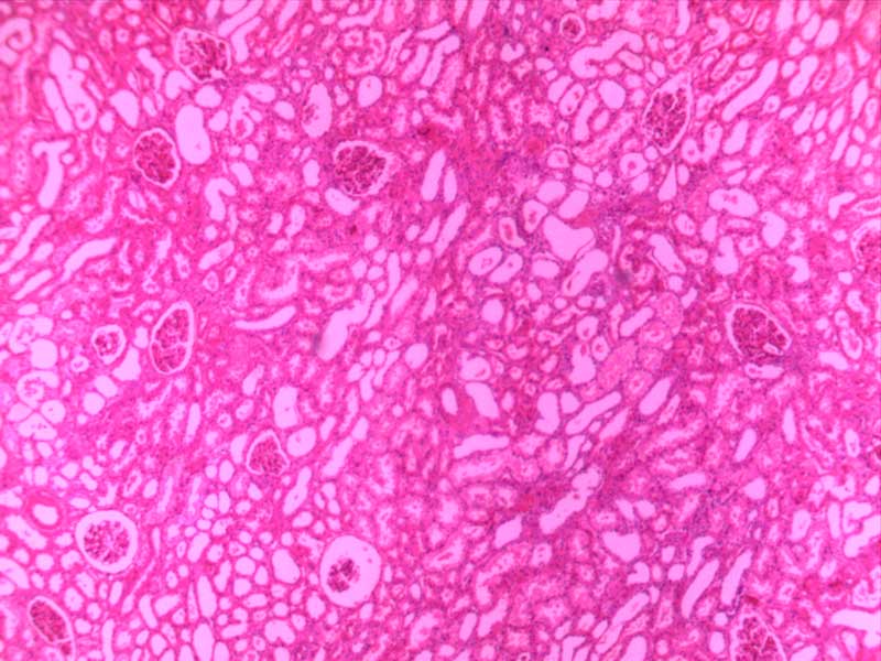 肾细胞水肿-4倍