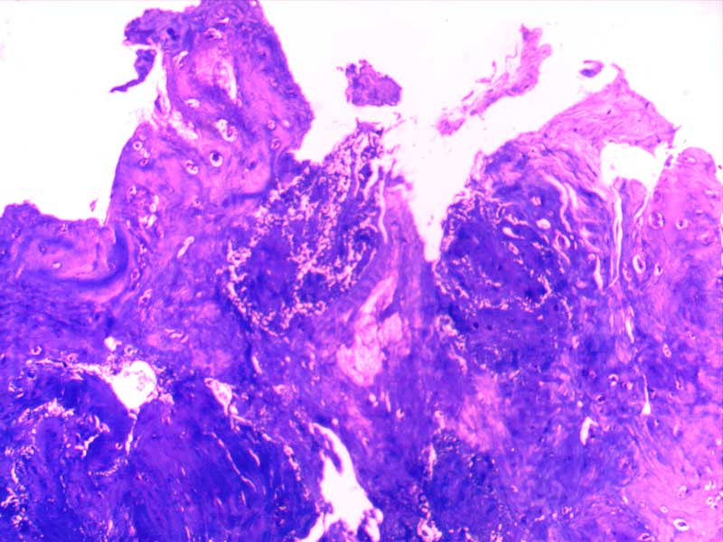 犬膝关节损伤切片-（亚甲蓝染色）4倍
