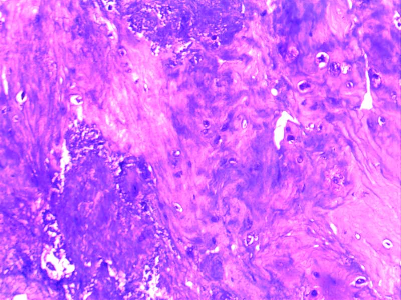 犬膝关节损伤切片-（亚甲蓝染色）