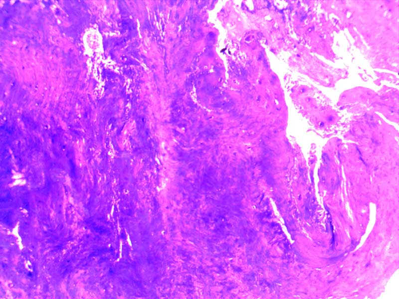 犬膝关节损伤切片-（亚甲蓝染色）