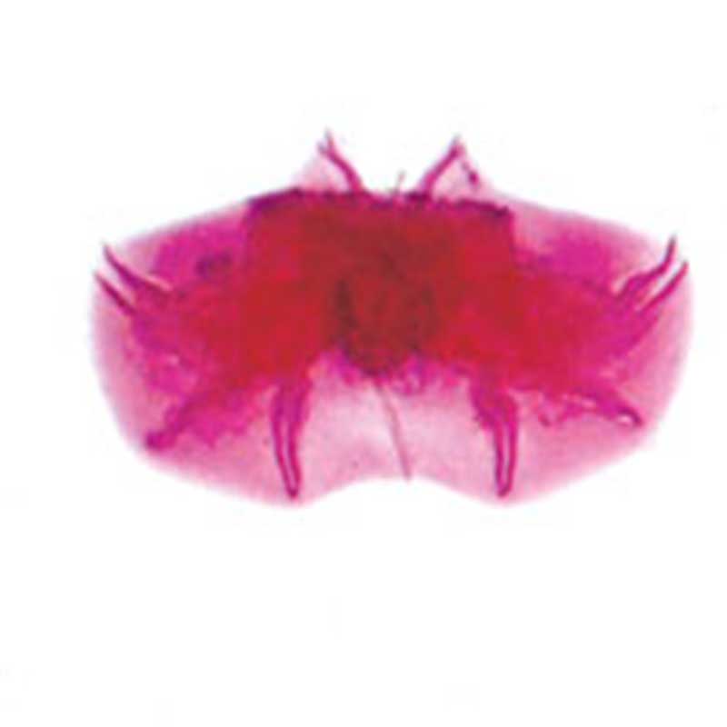 美洲板口线虫交合伞装片