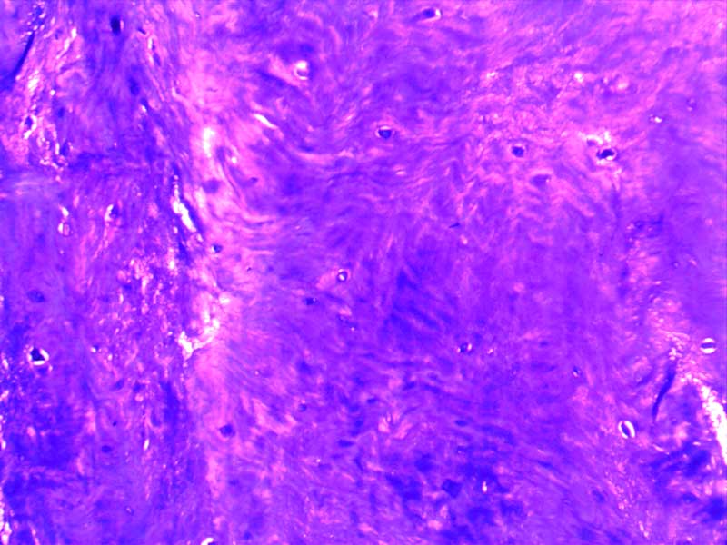 犬膝关节损伤切片-（亚甲蓝染色）